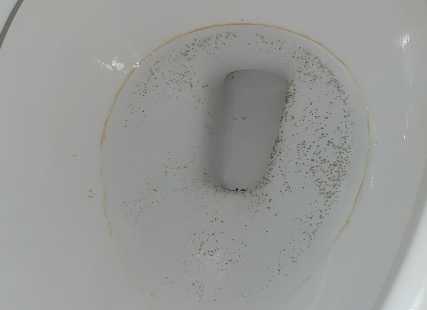 馬桶黑點 糖尿病