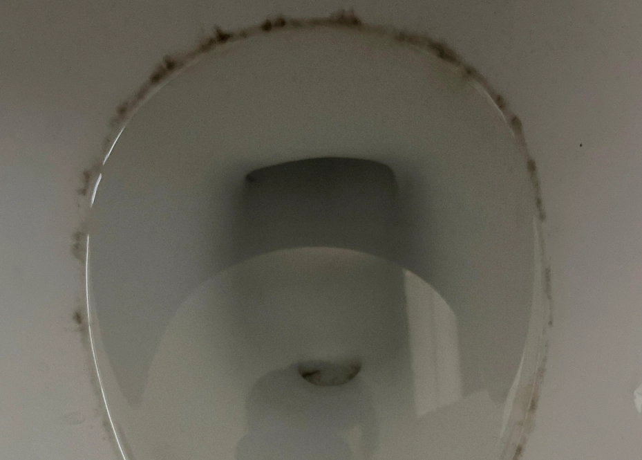 馬桶黑點 糖尿病