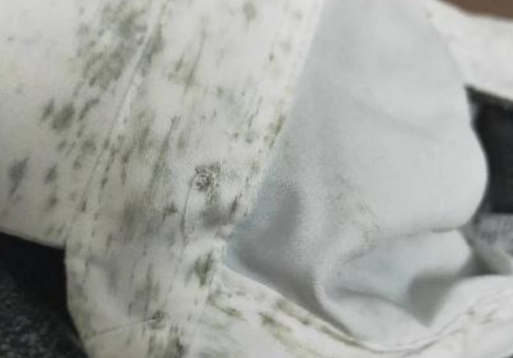 防止內褲發霉 防止內褲發霉