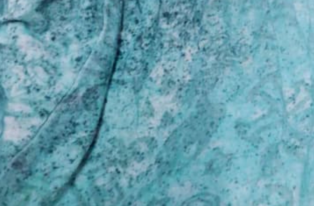 內褲發霉怎麼辦