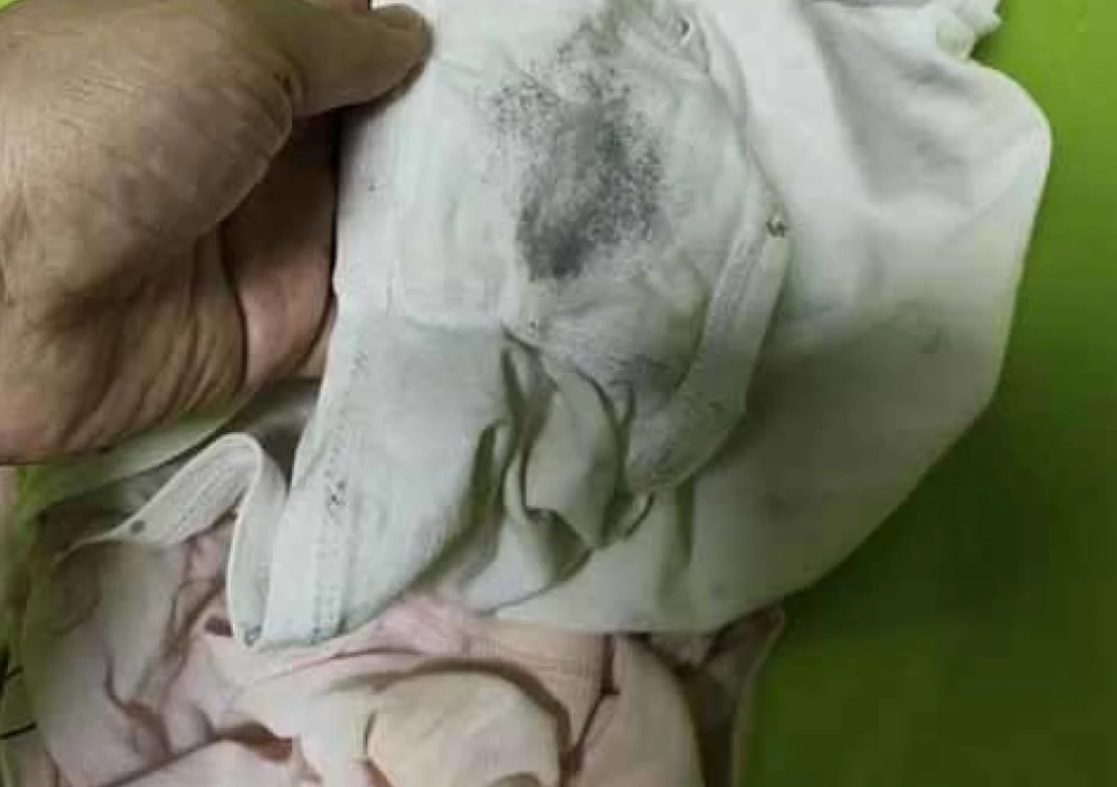 內褲黑點原因 內褲黑點原因