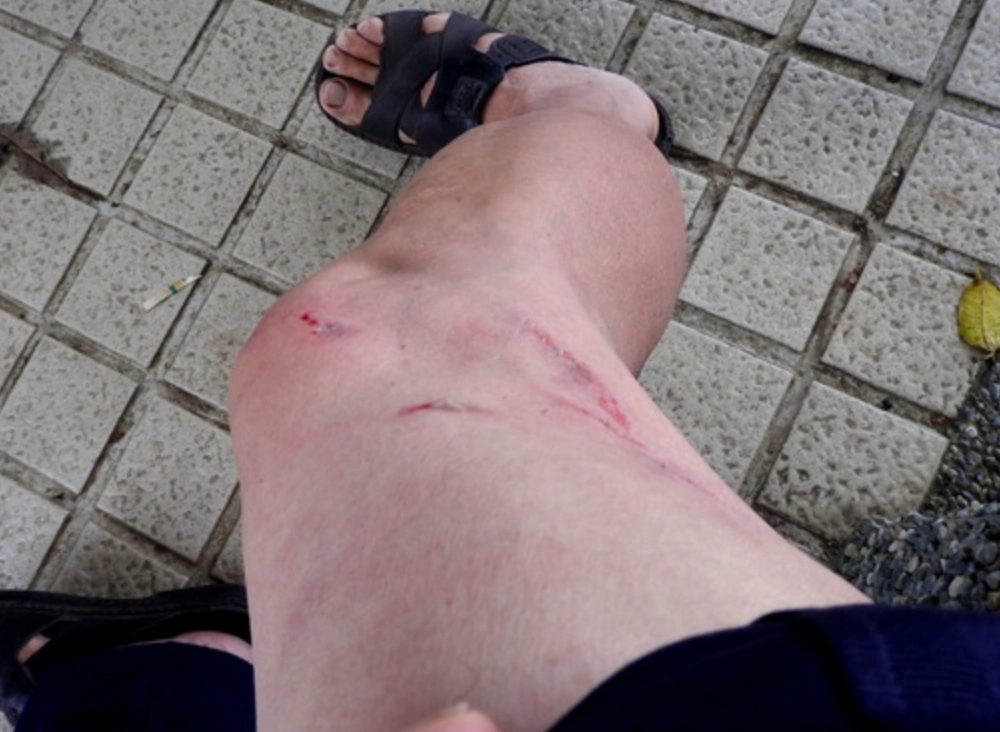 夢見被狗咬大腿