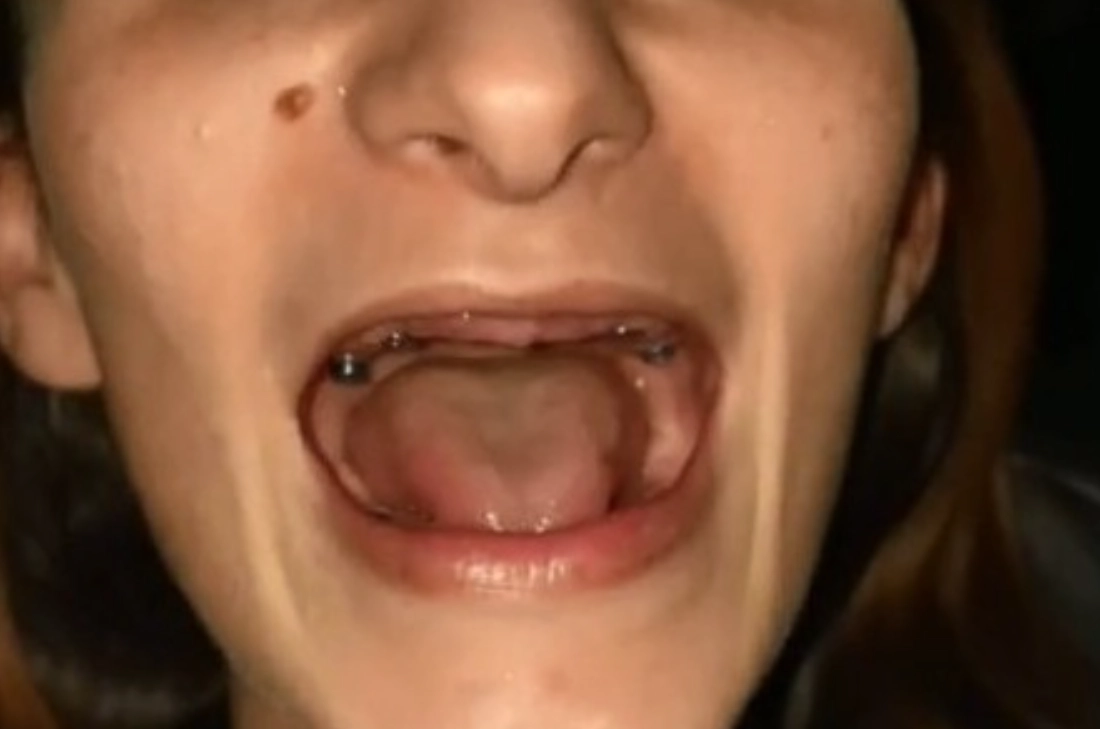 夢到牙齒掉光 心理