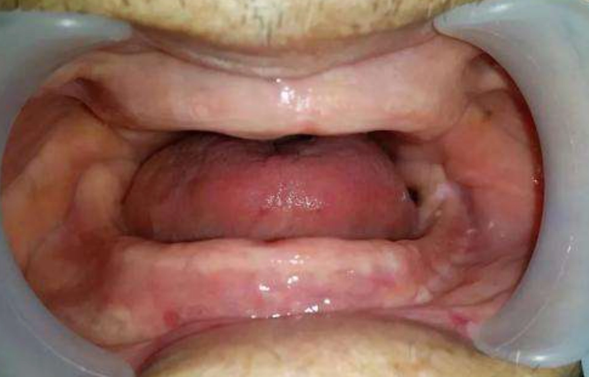 夢到掉牙齒 怎麼辦