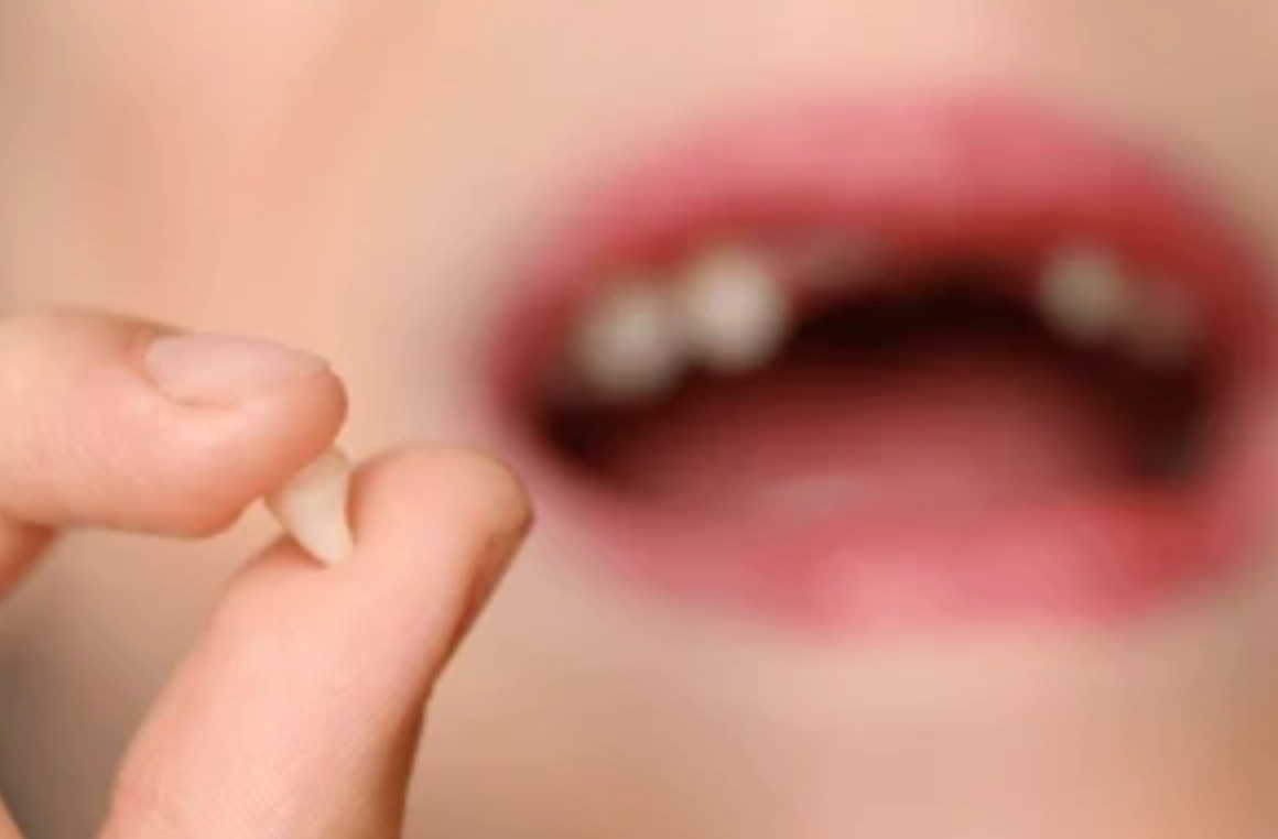 女人夢見掉牙齒