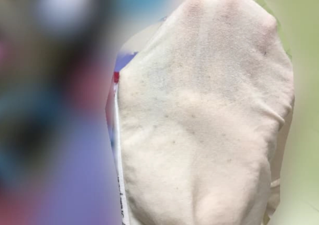 內褲發霉怎麼洗