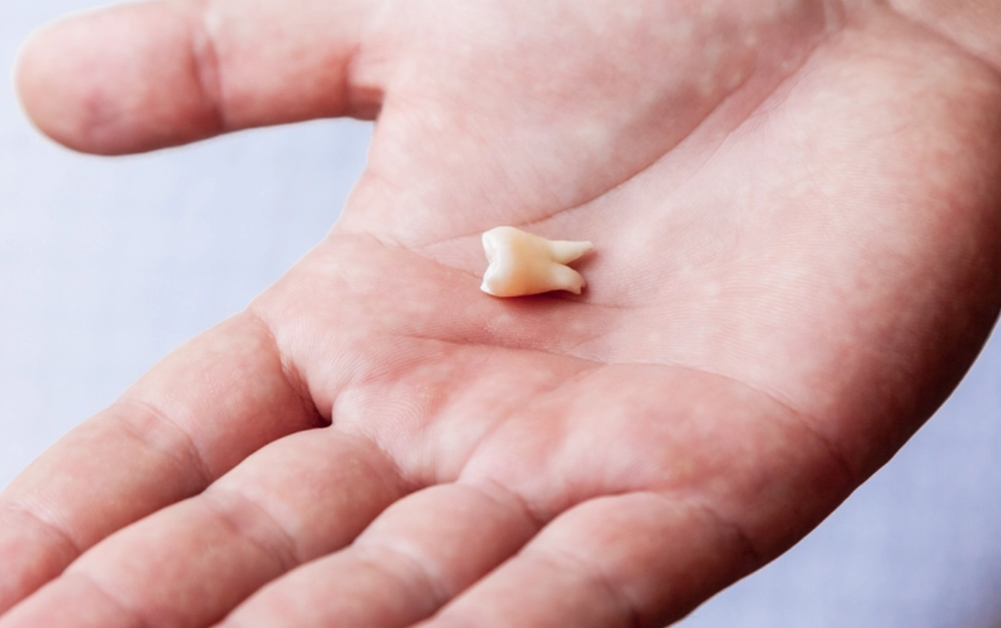 夢見掉牙齒沒流血