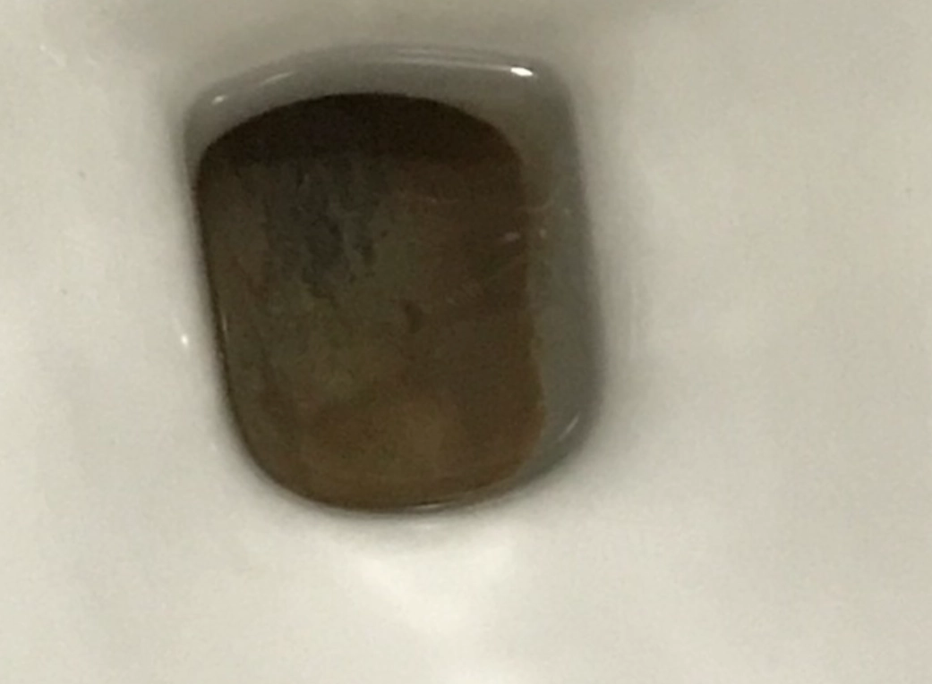 馬桶黑垢如何清除