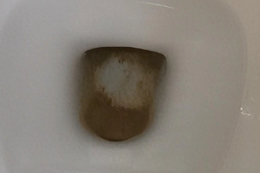 馬桶黑垢清潔 馬桶黑垢清潔