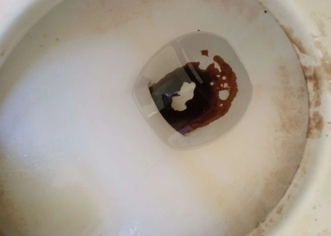 馬桶黑垢如何清除 馬桶黑垢如何清除