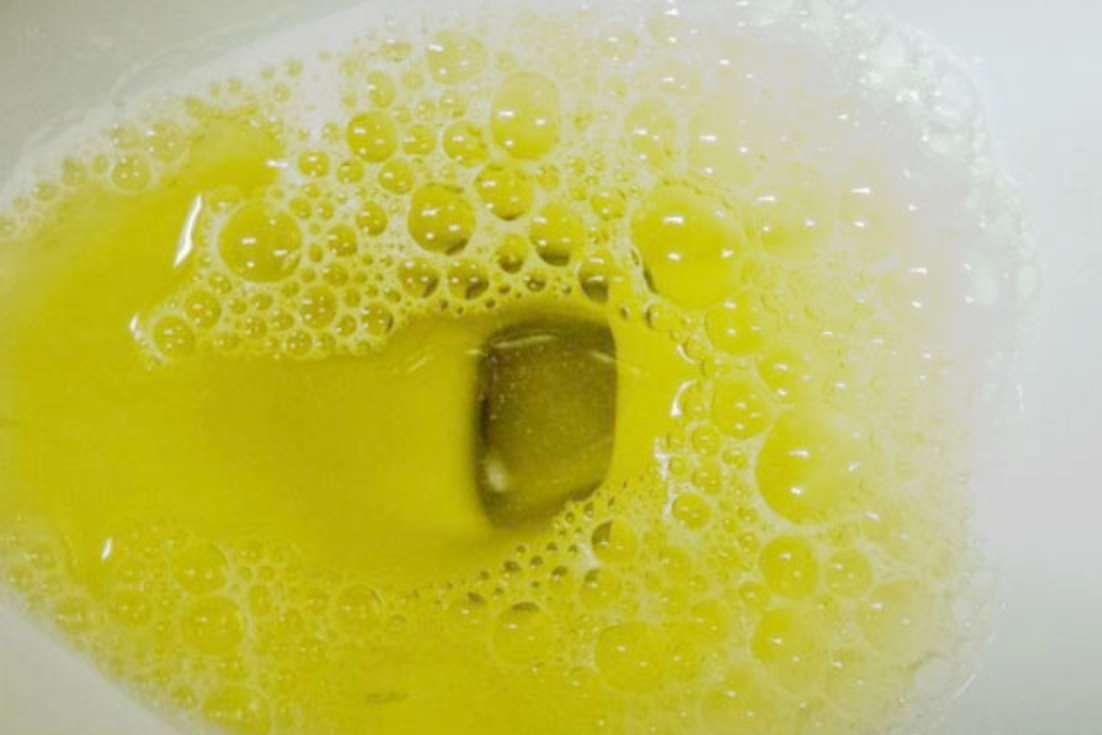 糖尿病尿液泡泡是警訊？看懂小便泡沫與高血糖的關鍵連結