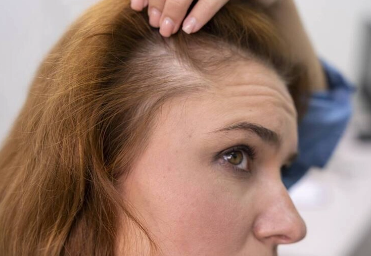 夢見頭頂禿一塊