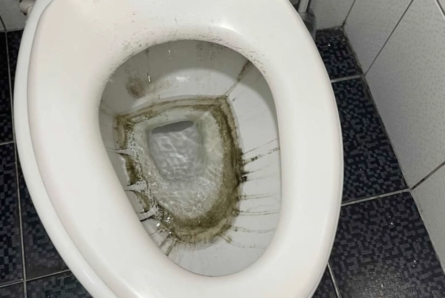 糖尿病馬桶發霉
