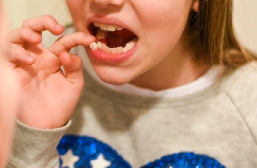 牙齒夢境心理學