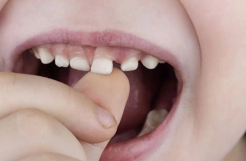 牙齒夢境心理學