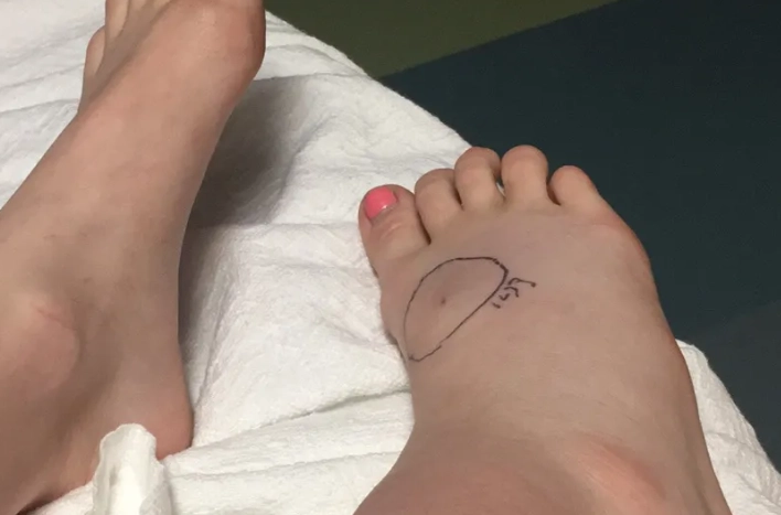 蛇咬腳趾夢境解析