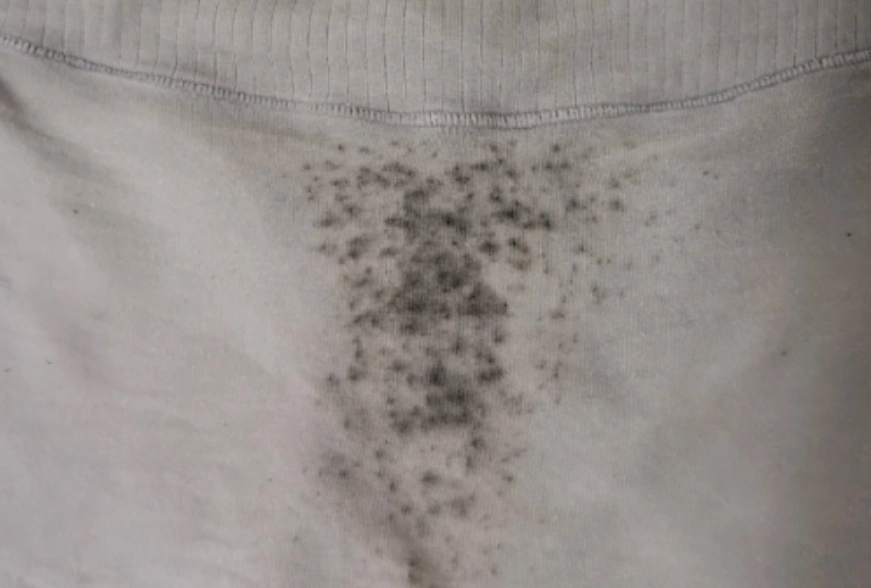 內褲發霉 內褲發霉