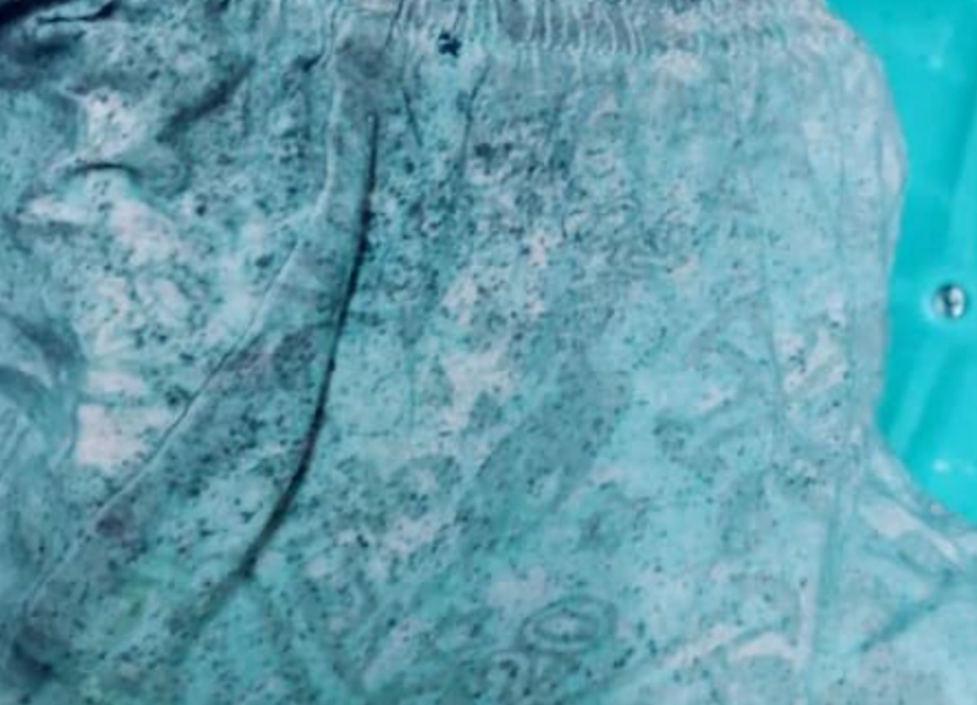 內褲發霉處理 內褲發霉處理