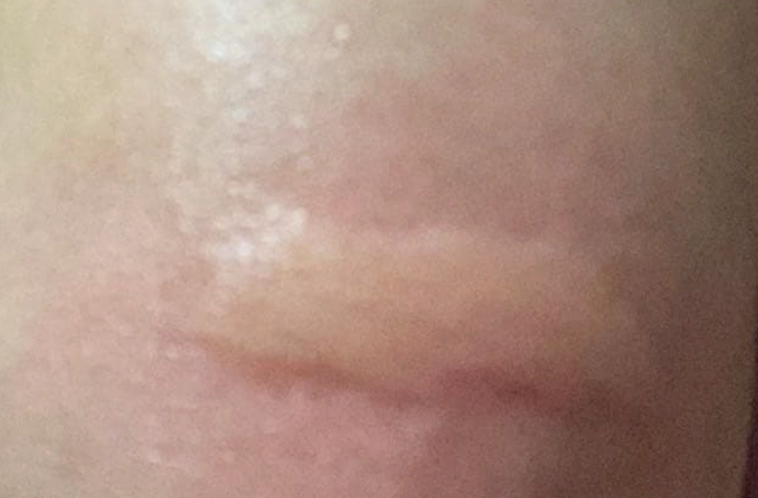 夢到被螞蟻咬 解夢