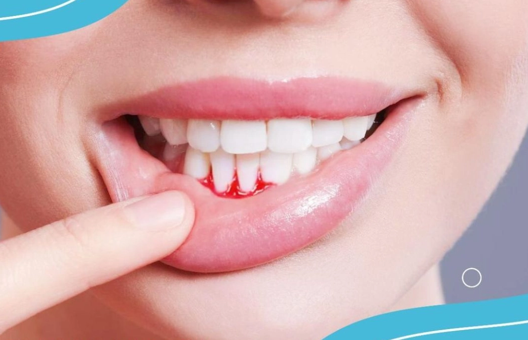 夢境牙齒脫落解夢