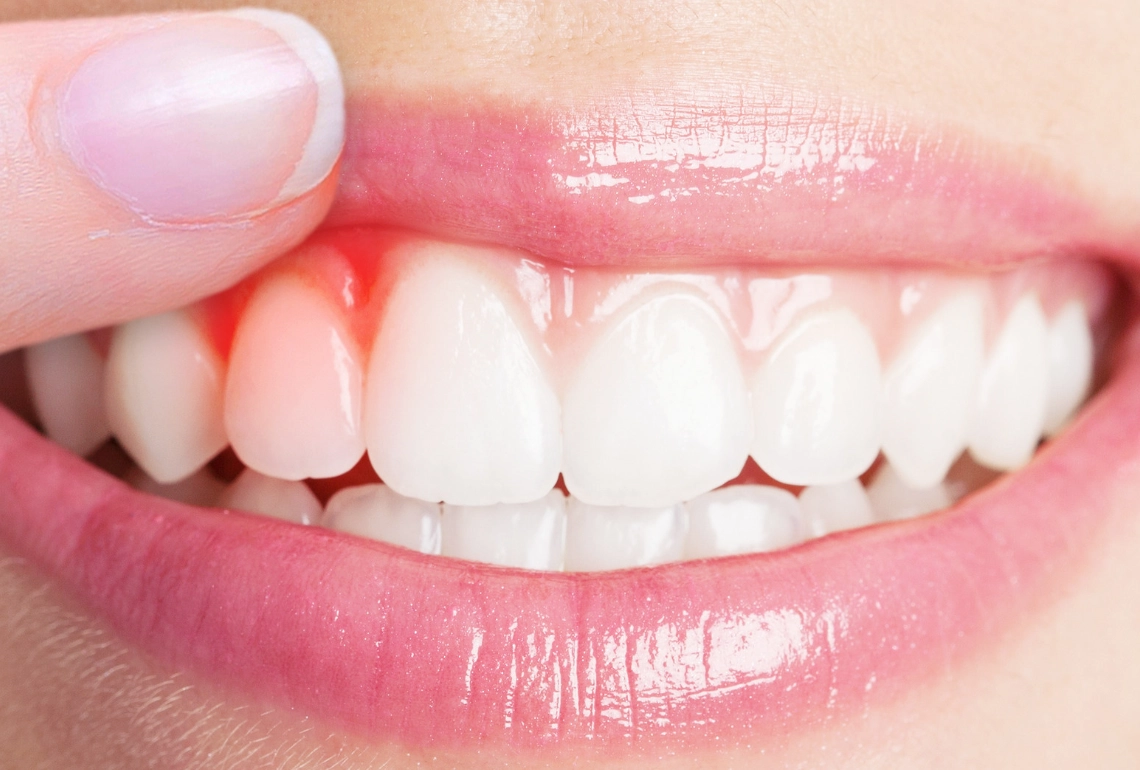 牙齒鬆動夢境心理學