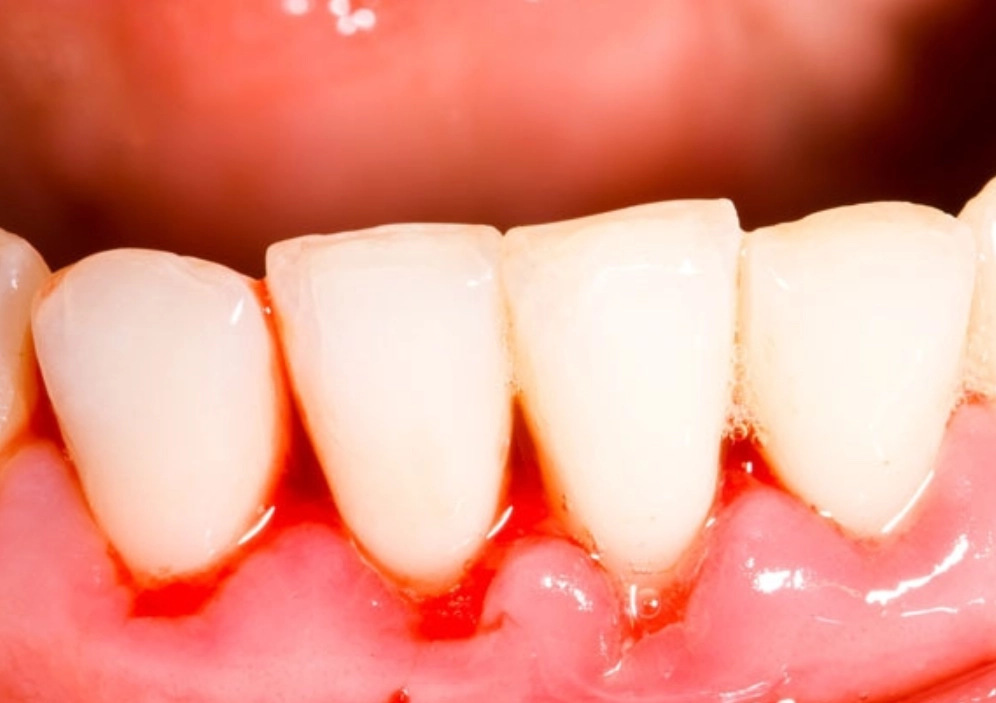 牙齒鬆動夢境心理學