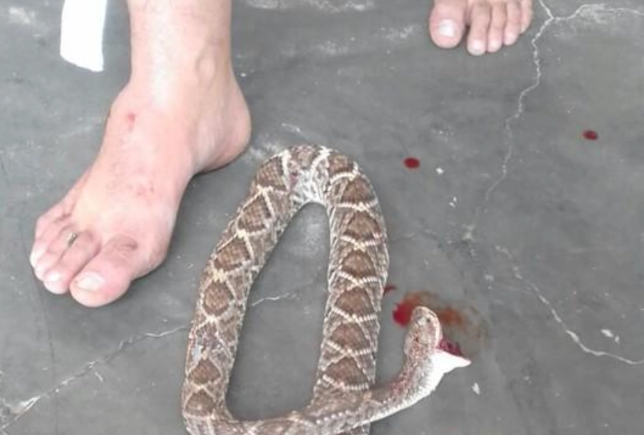 夢見被蛇咬腳 解夢 夢見被蛇咬腳 解夢