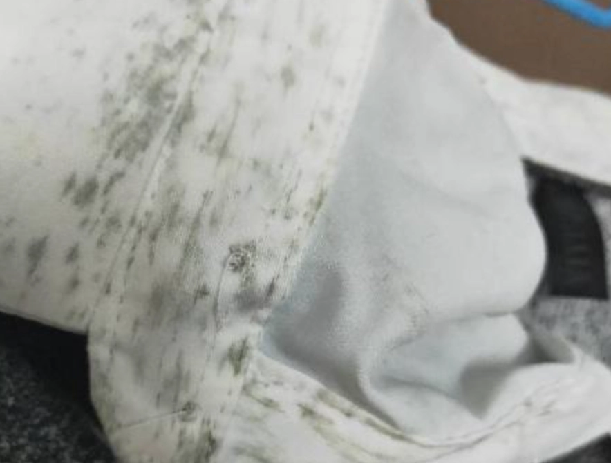 內褲發霉還可以穿嗎