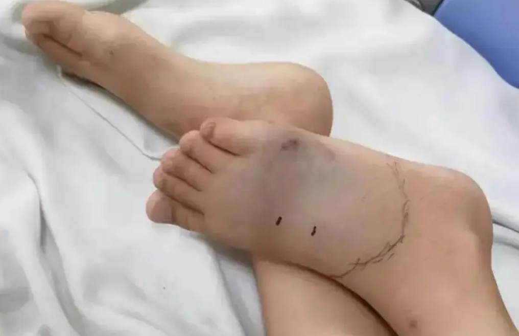 夢見被蛇咬腳 夢見被蛇咬腳