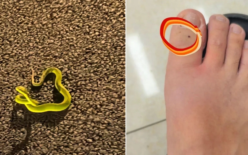 夢到被蛇咬腳指