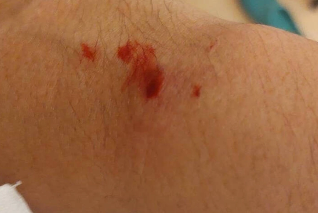 夢見紅蛇咬人 夢見紅蛇咬人