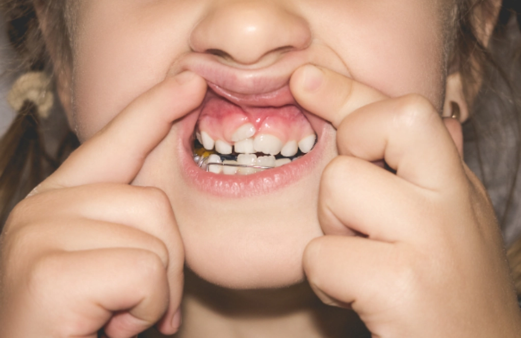 夢到牙齒快掉了